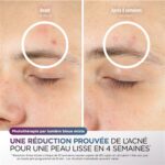 Máscara LED Shark CryoGlow Lilac - Imagen 6